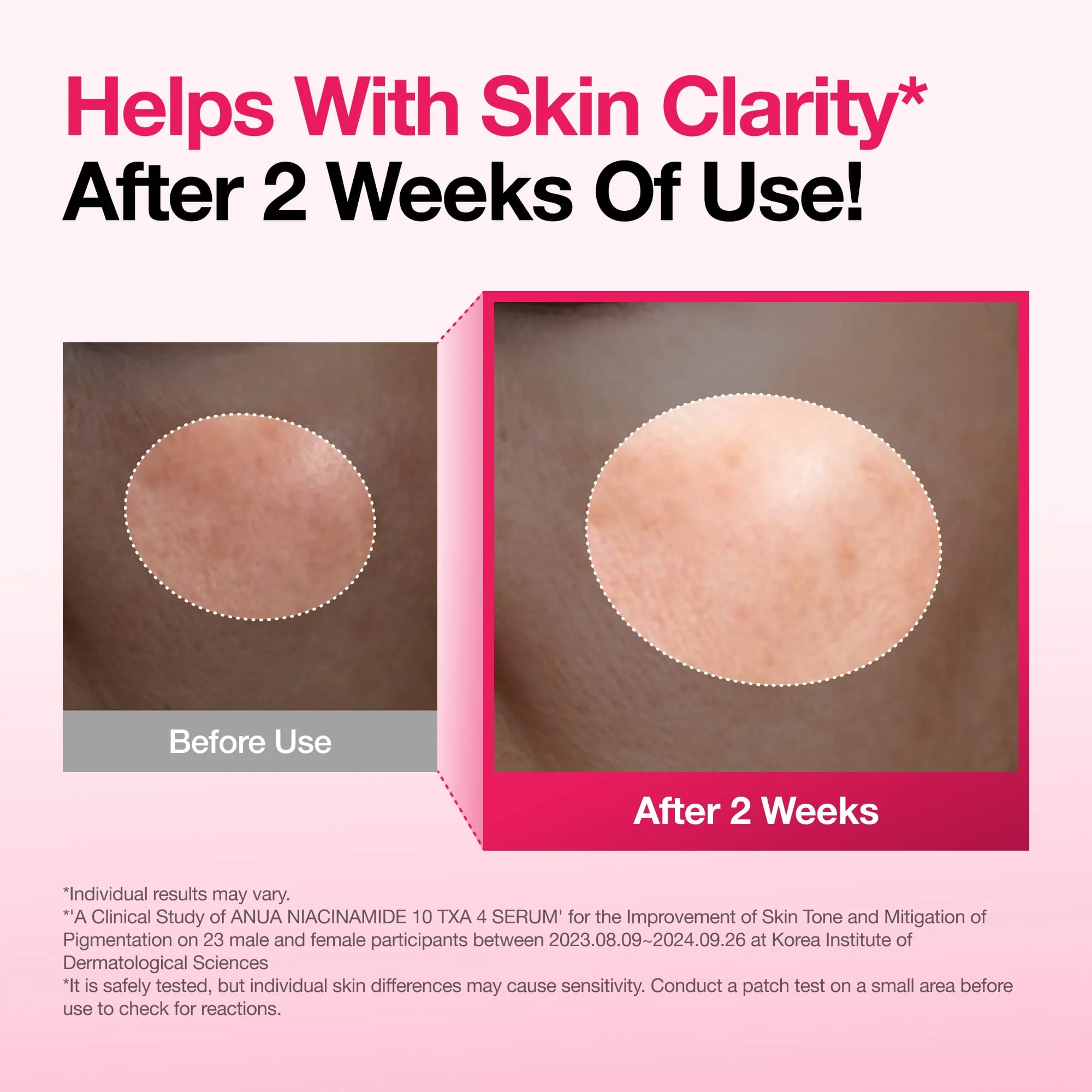 Anua Niacinamide 10% + Txa 4% Serum — view 3