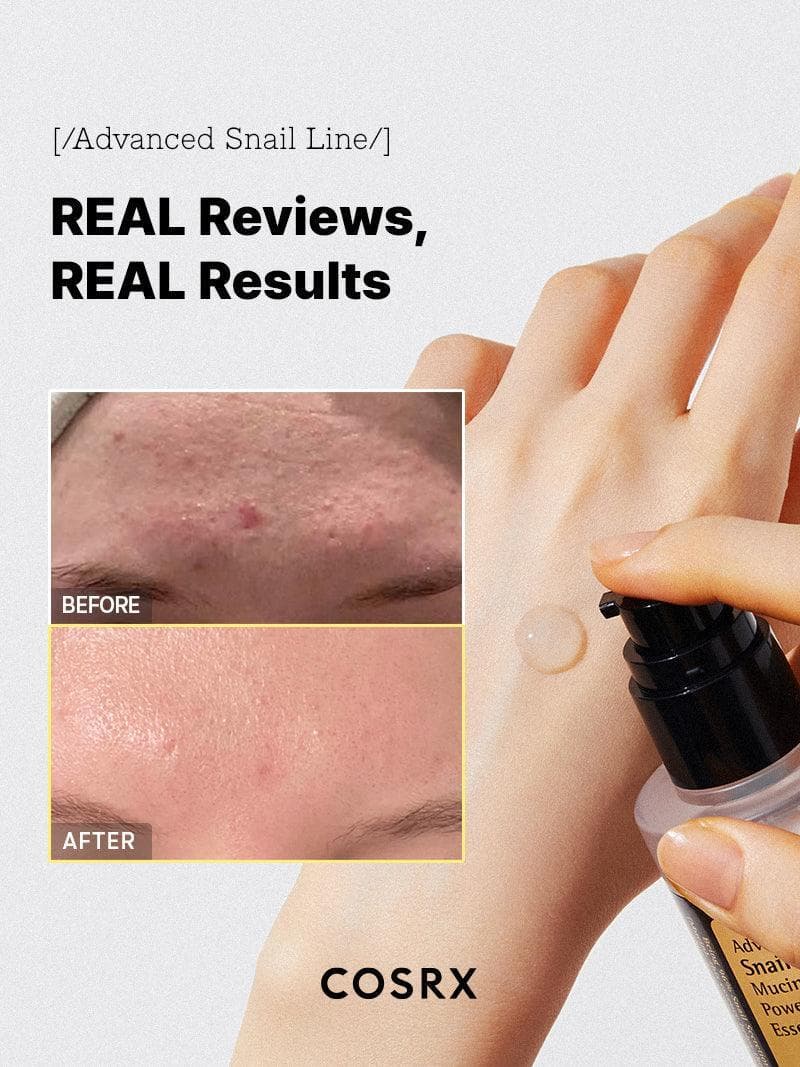 Cosrx advanced snail 96 mucin power essence — view 5